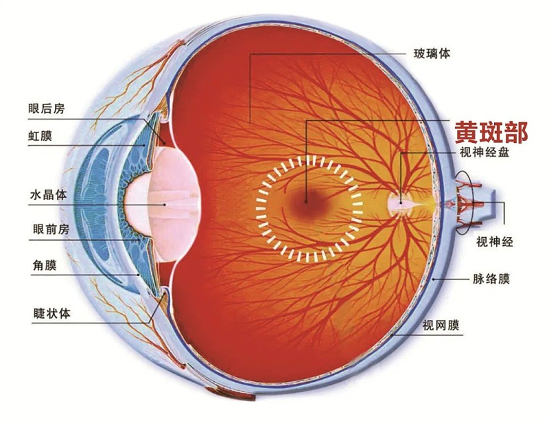 水蛭素、黃斑變性