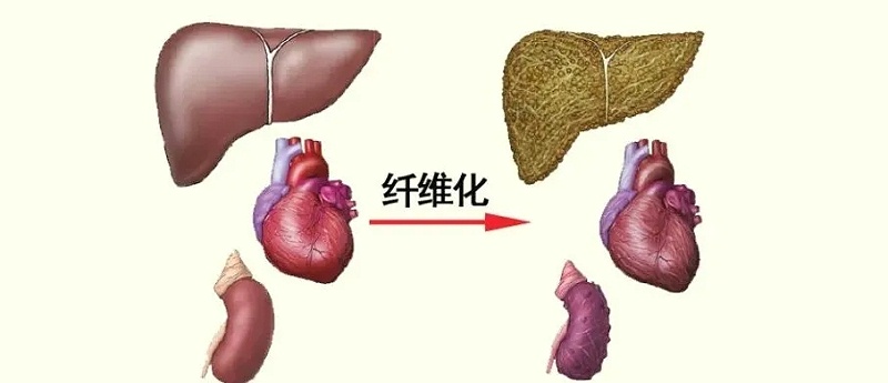 水蛭素、活血化瘀、纖維化