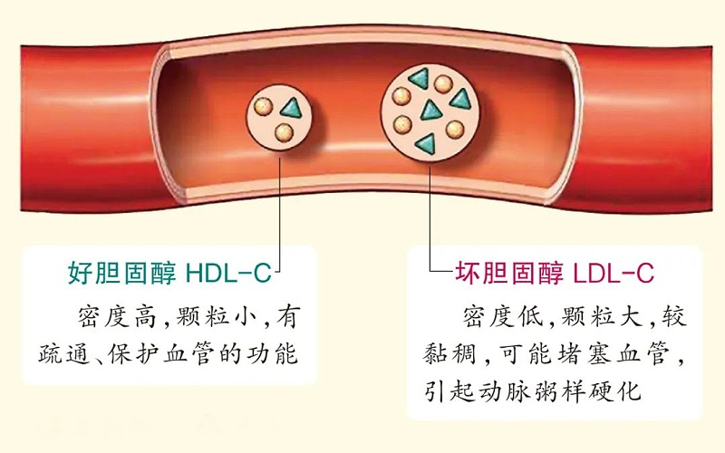 水蛭素、膽固醇、壯醫(yī)水蛭療法培訓(xùn)