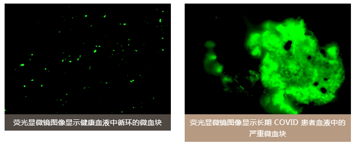 水蛭素、老年癡呆、前列腺、陽康