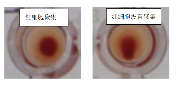 水蛭素、新冠病毒、壯醫(yī)水蛭療法